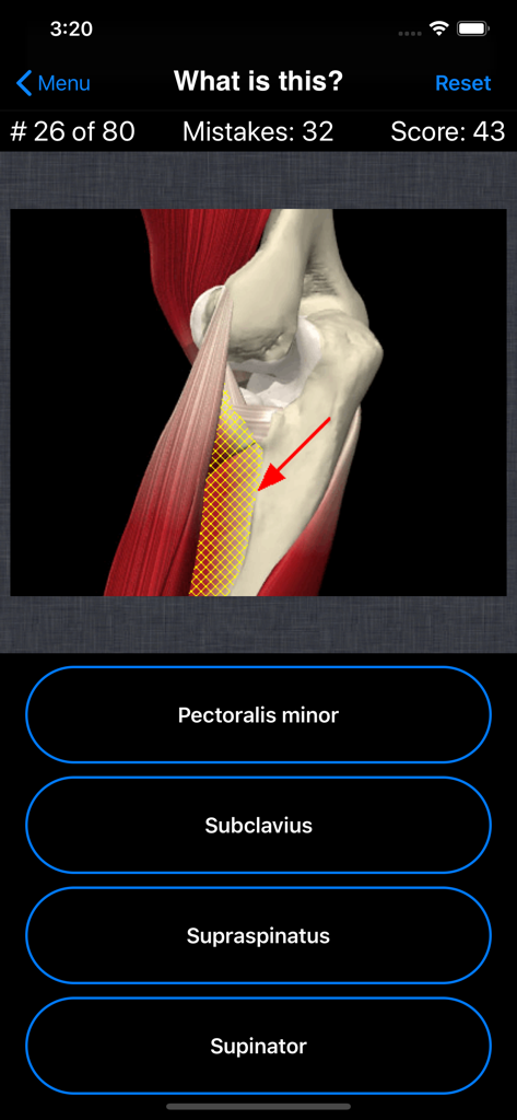 Anatomy Shoulder Quiz - Screenshot of a multiple choice question in the Anatomy Shoulder Quiz app featuring an anatomical illustration of shoulder muscles.
