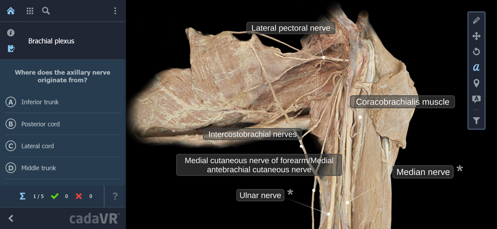 Screenshot of the cadaVR anatomy app featuring a labeled 3D specimen of the brachial plexus and a multiple-choice medical quiz.