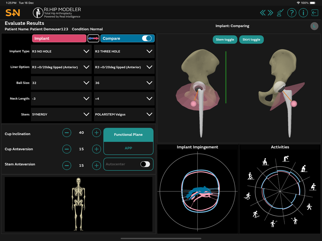 RI.HIP MODELER - Medical App | MWM