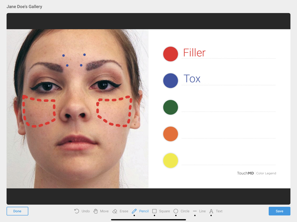 TouchMD Consult - for Staff - iPad interface showing a patient photo annotated with red and blue markers for filler and tox procedures with a color legend