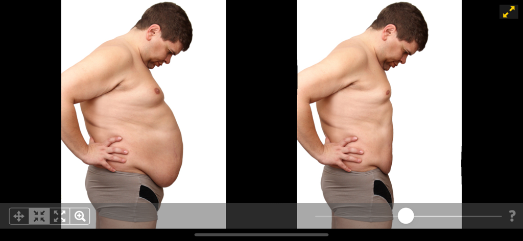 Trasformazione del corpo prima e dopo utilizzando un'app di fotoritocco per snellire il corpo