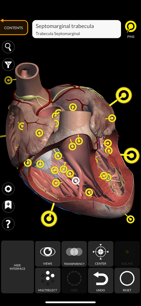 Anatomy 3D Atlas - Interactive 3D model of a human heart with anatomical pins and cross section view