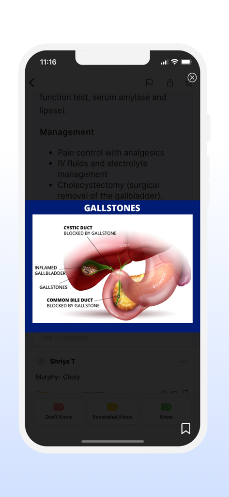 FNP Exam Mastery | Prep 2026 - Medical diagram of gallstones and biliary blockages in the FNP Exam Mastery app