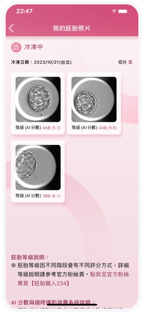 Nuwa Healthcare - Nuwa Healthcare app display of embryo microscopic images with AI grading and freezing status information