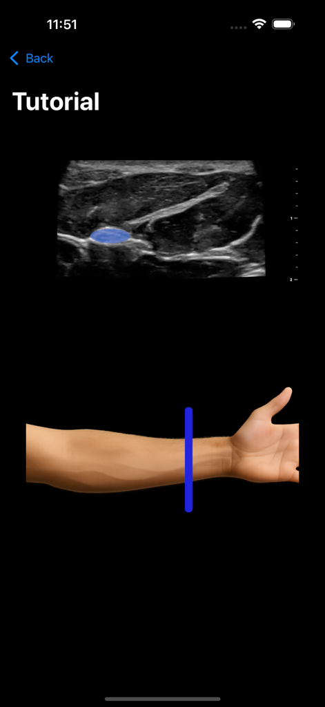 MSK VUE - MSK VUE app tutorial screen featuring an ultrasound image with a highlighted structure and a forearm anatomy diagram
