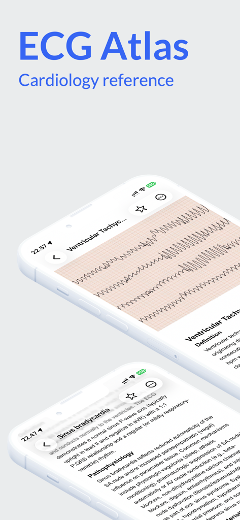 Screenshots der EKG Atlas App, die einen Ventrikuläre Tachykardie Rhythmusstreifen und Sinusbradykardie medizinische Referenzdetails zeigen.