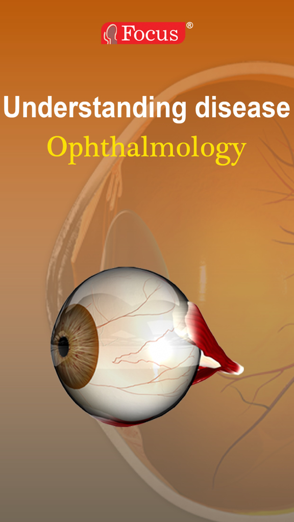 3D eye anatomy model on the splash screen of the Ophthalmology Understanding Disease medical app