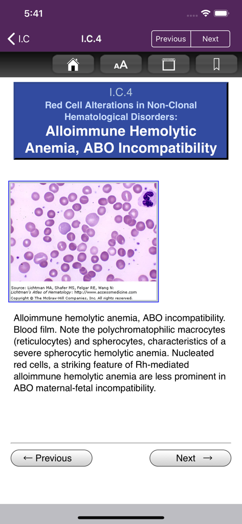 Microscopic blood film view of alloimmune hemolytic anemia within the Lichtmans Atlas of Hematology app.