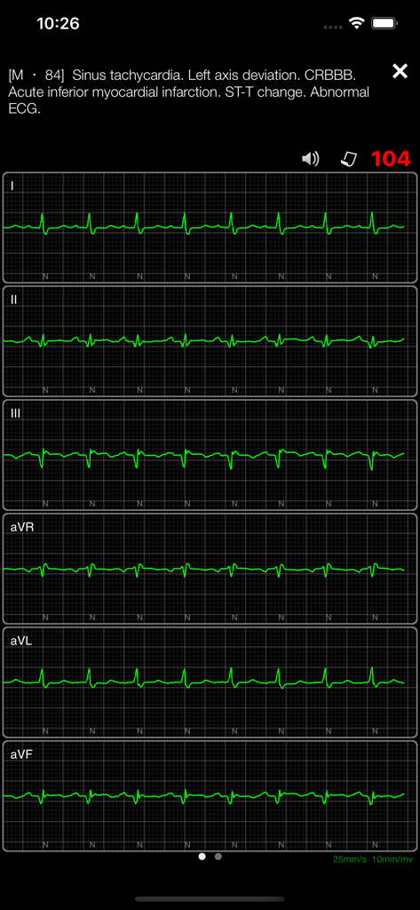 ECG Books Pro - Mobile app interface showing real-time ECG strips for medical training