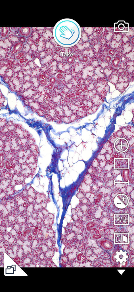 i-NTER SHOT2 for microscope - Microscopic tissue view in the i-NTER SHOT2 app interface with imaging controls