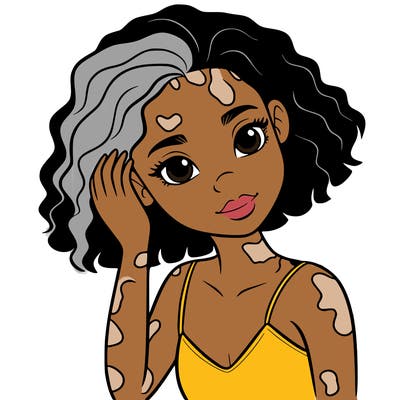 vitiligo black girl