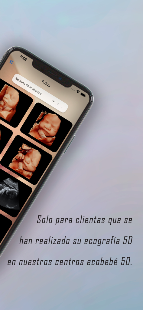 Smartphone mostrando una galería de fotos de ultrasonido 5D de bebés en la App Ecobebé