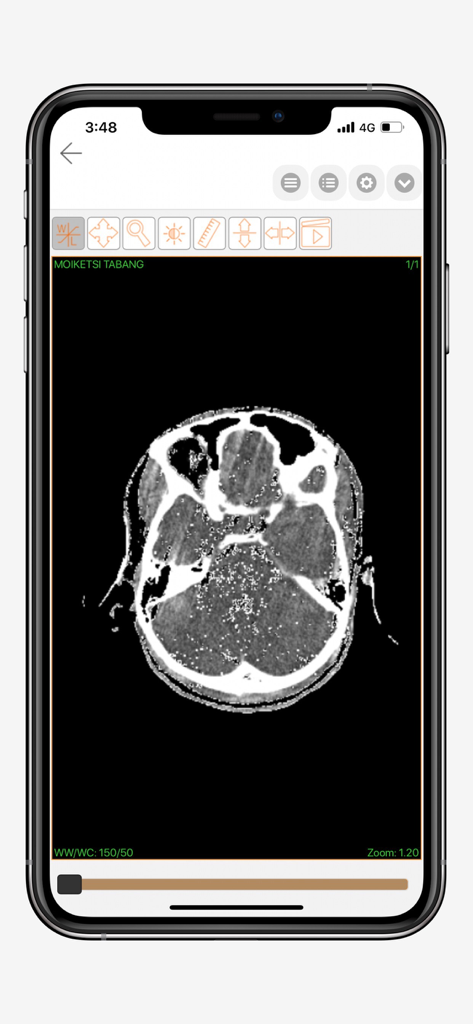 CareRad app displaying a radiology head scan with diagnostic imaging tools on a smartphone