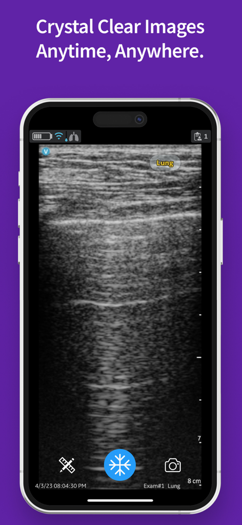 Tela do iPhone mostrando um exame de ultrassom pulmonar veterinário com qualidade de imagem cristalina usando o aplicativo Vscan Air VET