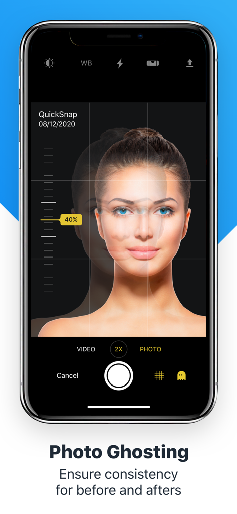 Interface do aplicativo RxPhoto mostrando o recurso de ghosting de fotos para alinhamento de pacientes