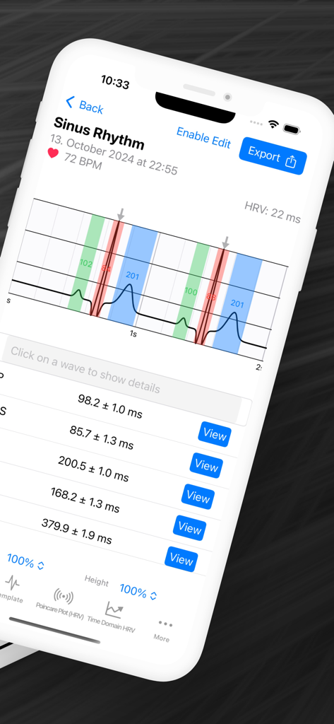 ECG AI - Medical App | MWM
