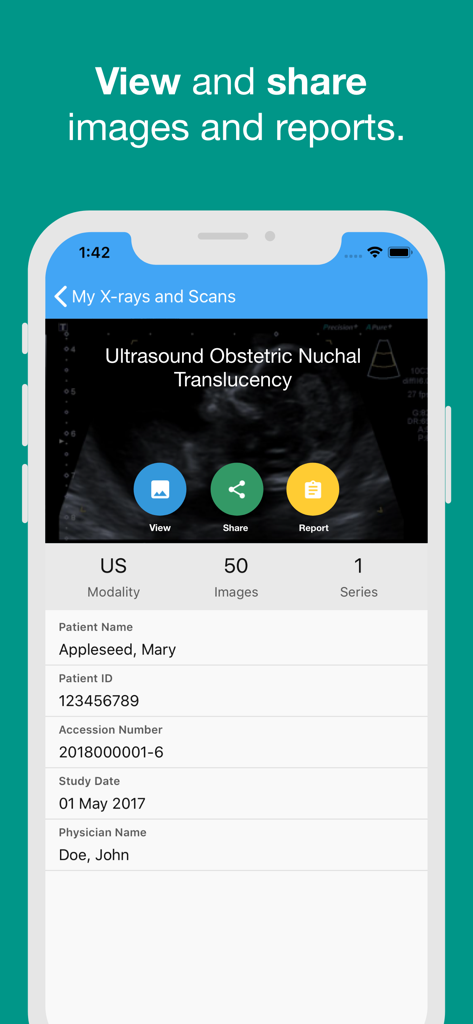 Captura de tela do aplicativo Horizon myRad mostrando resultados de ultrassom com opções para visualizar e compartilhar relatórios médicos