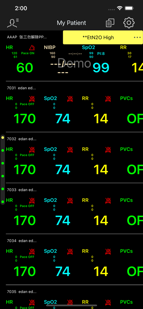 EDAN CMS - Interfaccia dell'app mobile EDAN CMS che mostra i parametri vitali del paziente in tempo reale, inclusi frequenza cardiaca, saturazione di ossigeno e frequenza respiratoria con una notifica di allarme attiva.
