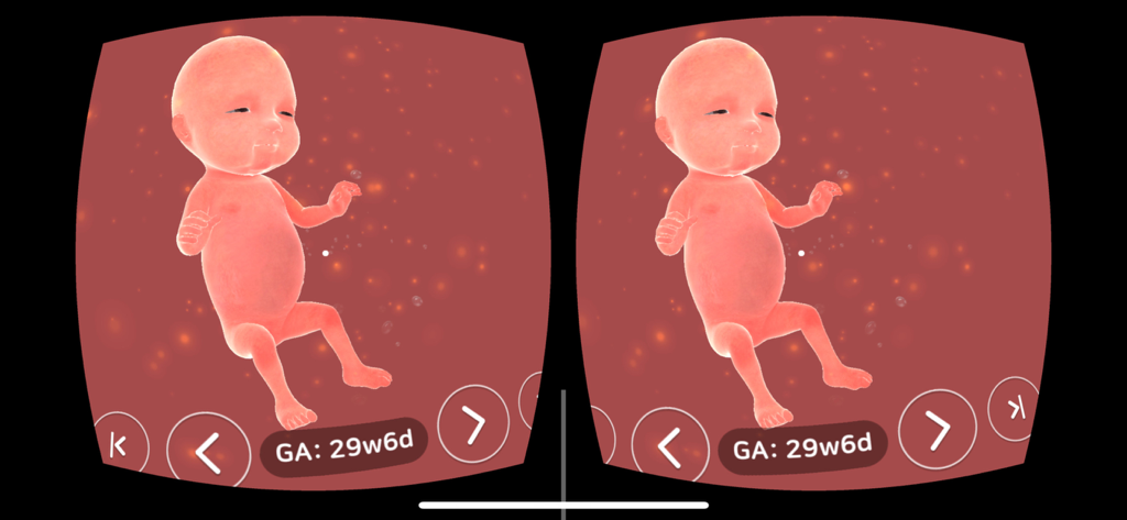 Aluvuu Fetus - Stereoscopic VR view of a 3D fetus model inside the Aluvuu Fetus application showing gestational age at 29 weeks