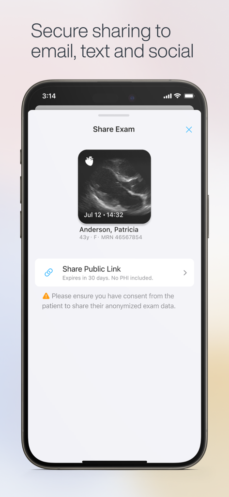 Exo Iris™ - Smartphone screen showing the Exo Iris app interface for securely sharing an ultrasound exam image