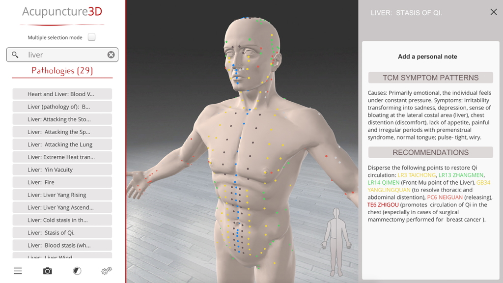 Applicazione Acupuncture3D che mostra un modello 3D con punti di agopuntura e dettagli di patologia MTC