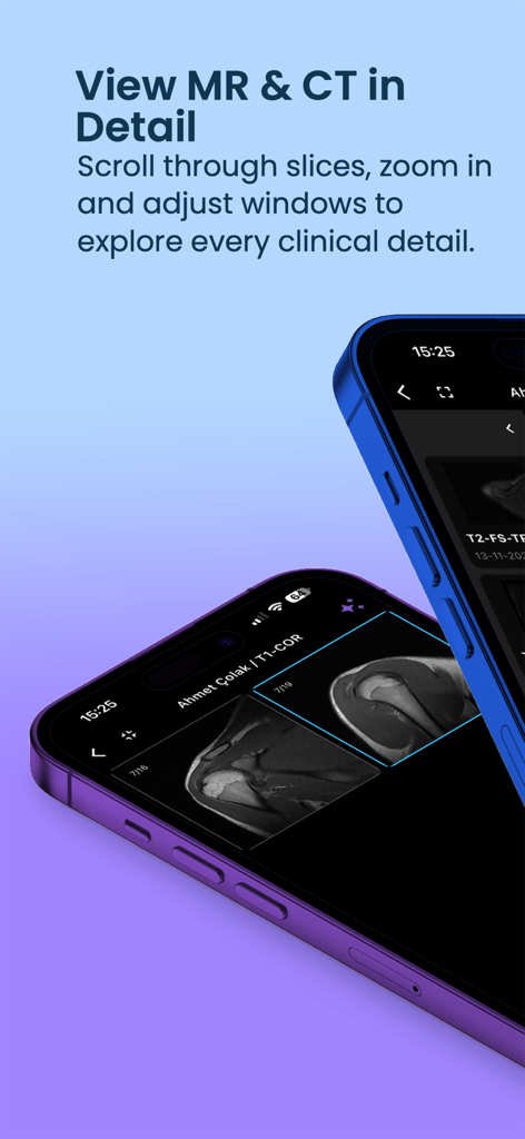 Kayrona DICOM AI Viewer - Kayrona DICOM AI Viewer app interface showing detailed MR and CT scan slices on a mobile device