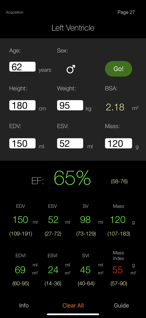 CMR Pocket Guide - CMRポケットガイドアプリのインターフェイス。左心室計算ツールが表示され、患者データと計算された心臓測定値の入力フィールドがあります。