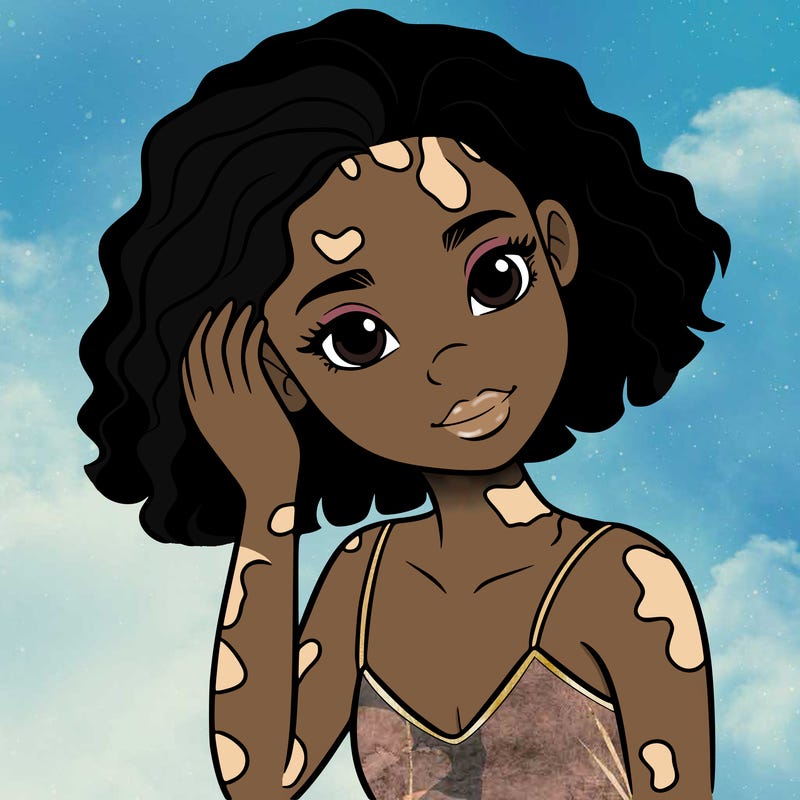 vitiligo black girl