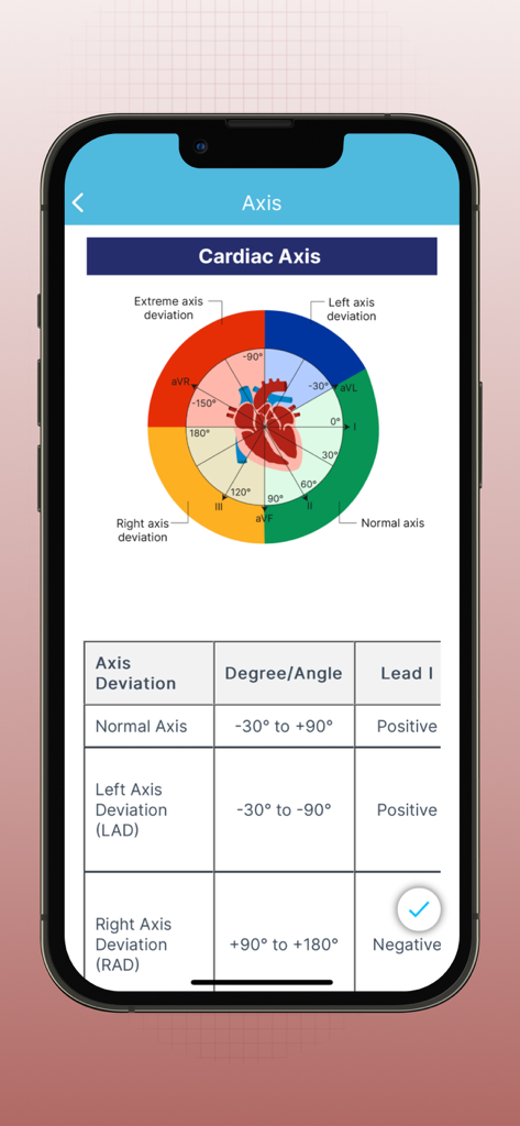 ECG EKG Interpretation Mastery - A detailed circular diagram and reference table for cardiac axis deviation in the ECG EKG Interpretation Mastery app.