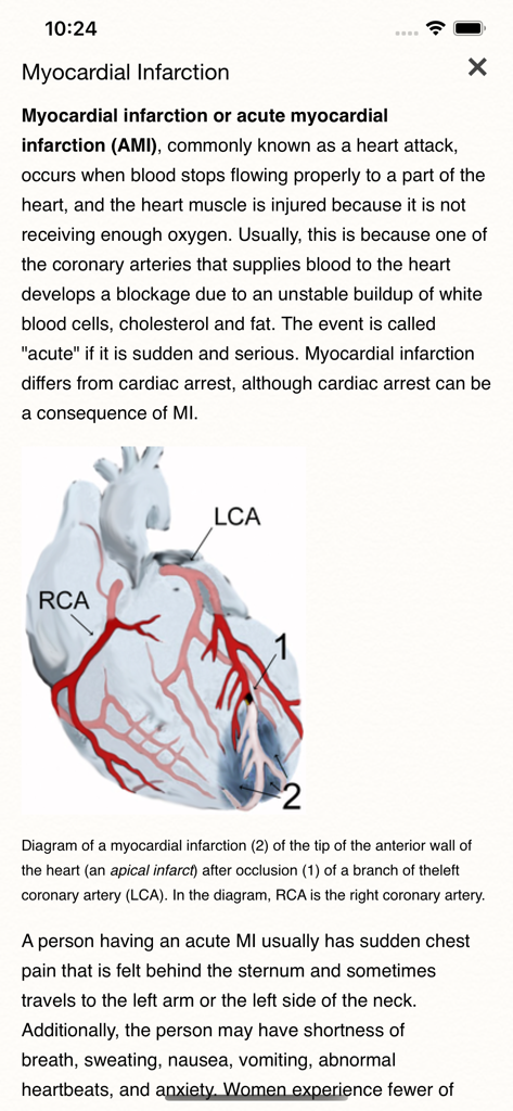 ECG Books Pro - Educational screen from the ECG Books Pro app detailing myocardial infarction with a heart diagram and symptoms