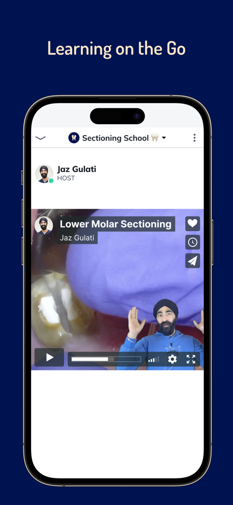 Pantalla de la aplicación móvil que muestra una lección de vídeo dental sobre la sección de molares inferiores con un instructor.