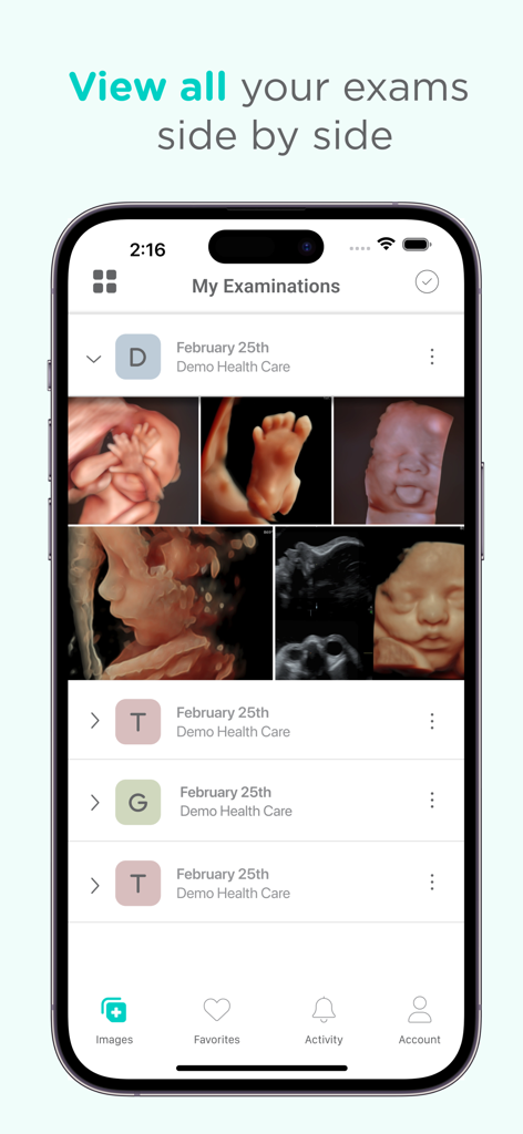 Pim - Your Medical Images - Pim app screen showing a list of medical examinations with 3D baby ultrasound images