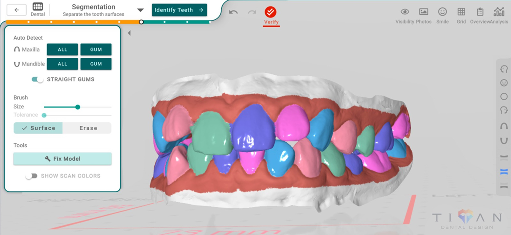 3D dental model showing tooth segmentation in the Titan Dental Design app interface