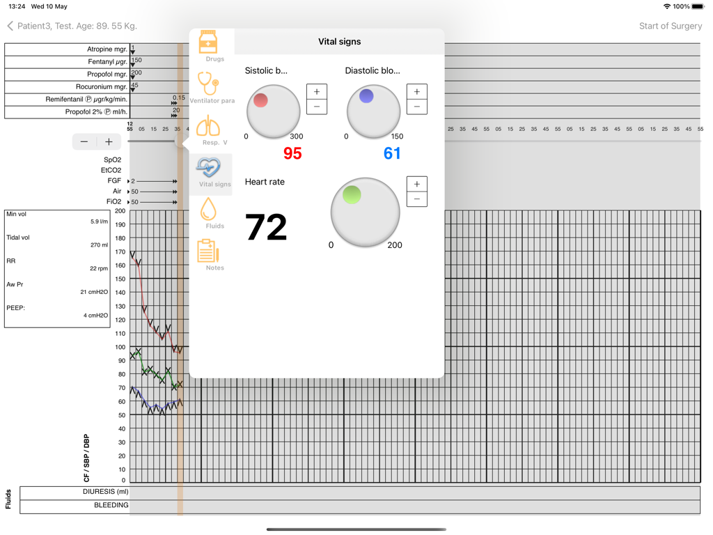 SIMpro1 | Digital Anesthesia Record & Real-time Monitoring