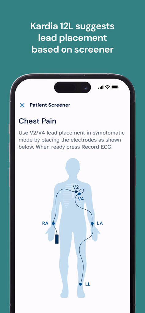 KardiaStation Professional - Aplicación de atención médica que muestra un diagrama para la colocación correcta de los electrodos de ECG en un paciente para la detección de dolor en el pecho.