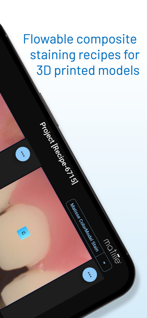 Matisse | Shade Matching - Interface of Matisse app showing flowable composite staining recipes for 3D printed dental models