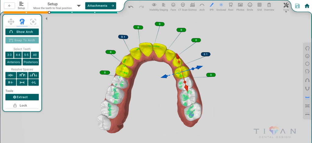 3D dental arch visualization and treatment planning interface