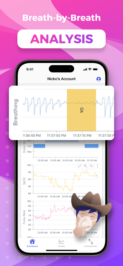SleepHQ - SleepHQ mobile app interface displaying detailed breath-by-breath analysis charts and SpO2 data