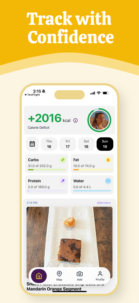 Last Calorie - Painel do aplicativo Last Calorie exibindo déficit calórico diário, progresso de macronutrientes, ingestão de água e uma foto de um lanche sendo rastreado