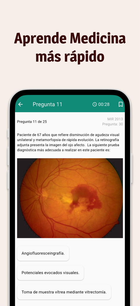 Interfaz de examen médico mostrando un caso clínico con una imagen de retinografía ocular en la app Preguntas Mir Me