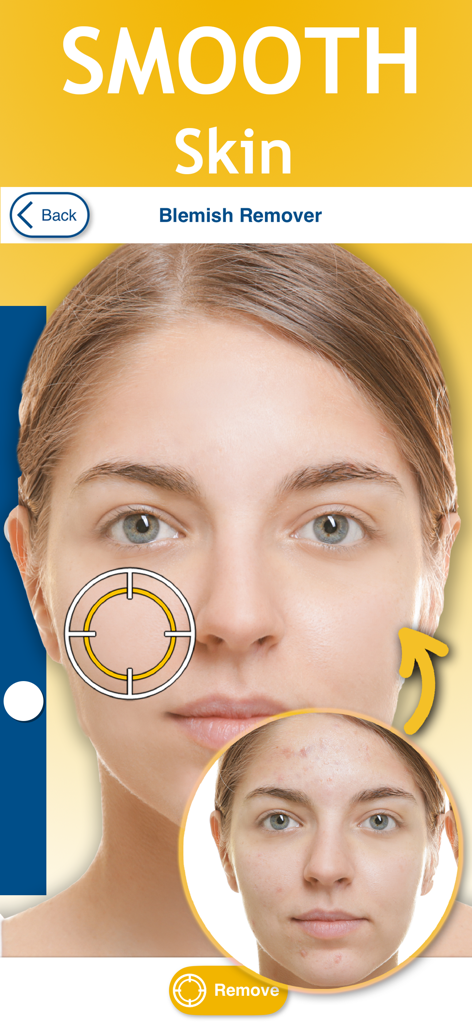 Uno screenshot che mostra un viso prima e dopo la rimozione delle imperfezioni e la levigatura della pelle nell'app Perfect Face Photo Editor.