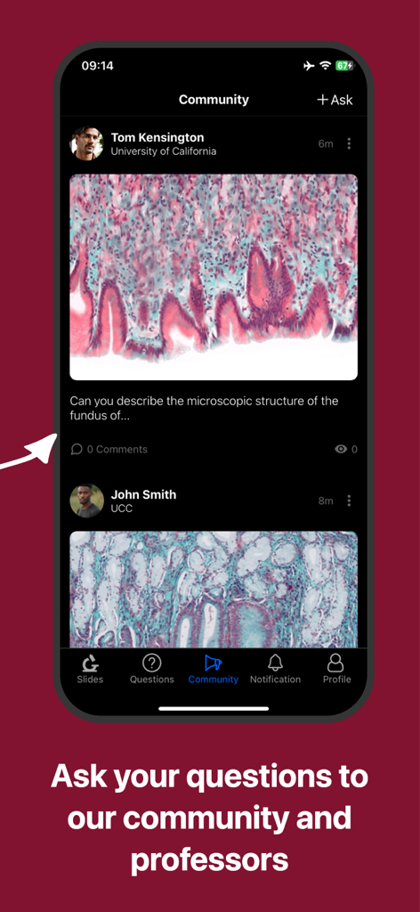 Interface of the Microlab Histology app showing a community forum where medical students and professors discuss histology slides