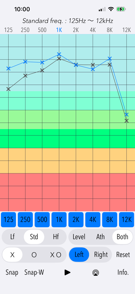 標準周波数にわたる左耳の聴力検査結果を示す周波数応答グラフ