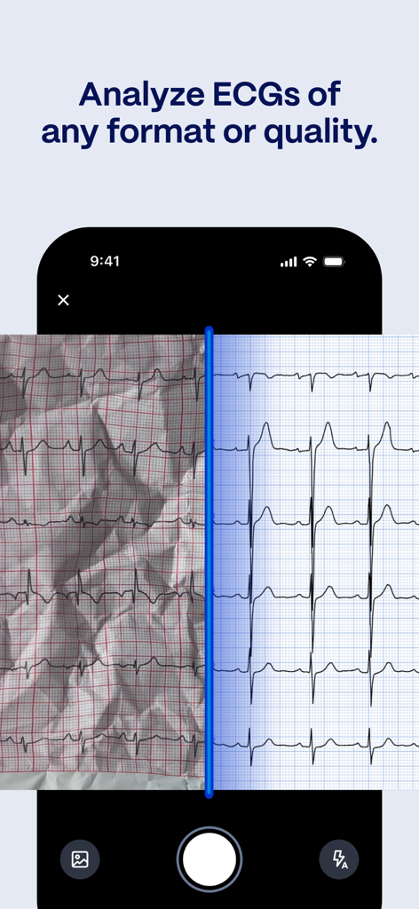 PMcardio for Individuals - A split screen comparing a crumpled paper ECG strip with its clear digital version processed by the PMcardio app