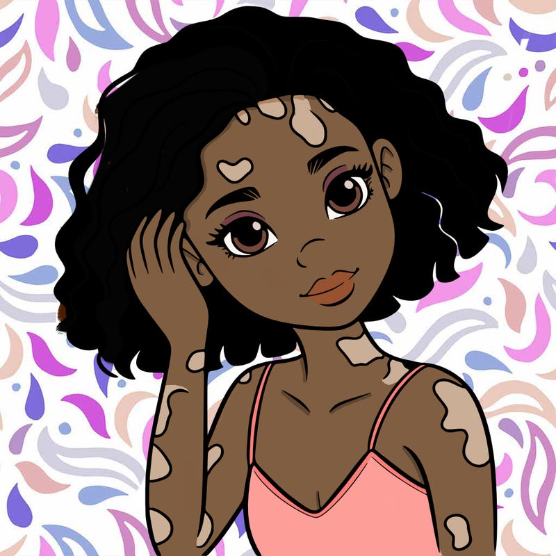 vitiligo black girl