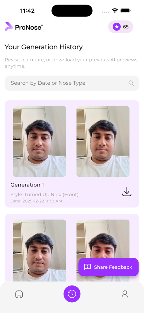 Generation history screen in the ProNose AI app showing previous nose job simulations