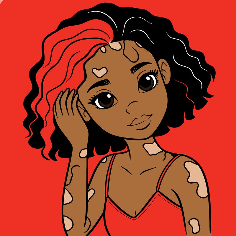 vitiligo black girl