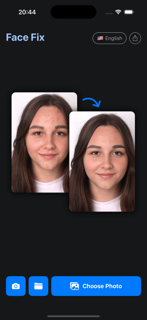 Photo Quality Enhancer FaceFix - FaceFix app showing before and after photo of skin acne removal