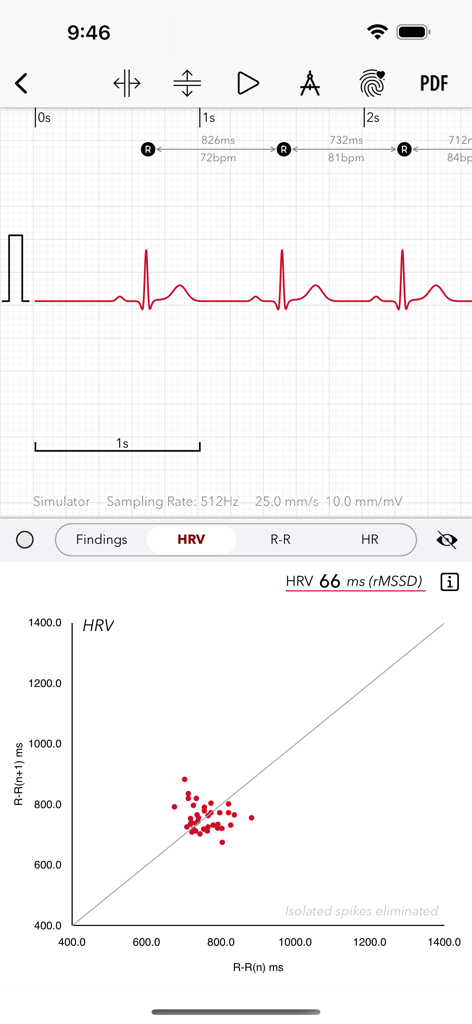 ECG+ | Your Watch ECG Reader - ECG waveform and Heart Rate Variability scatter plot data analysis on the ECG+ app