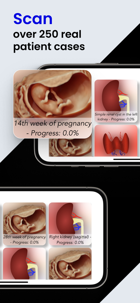 妊娠や腎臓のスキャンを含む250以上の実際の患者症例のライブラリ、Scanbooster Ultrasound Simアプリ